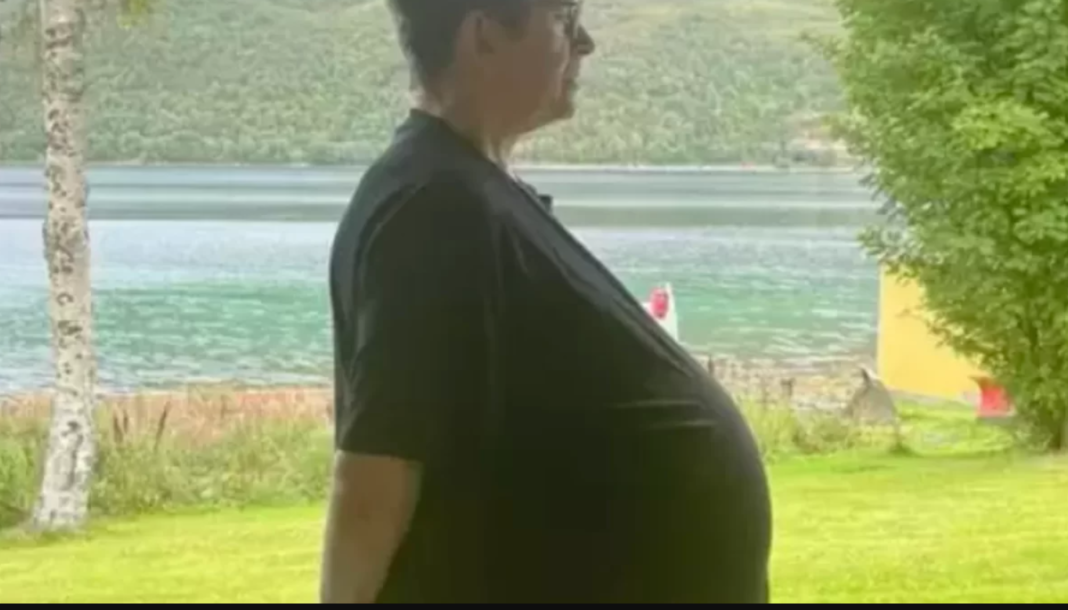Descoberta surpreendente mostra a importância de exames criteriosos para diagnósticos de obesidade (Foto: Instagram)