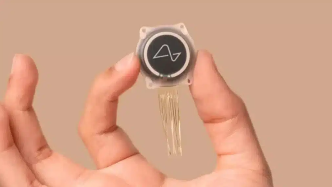 Tecnologia promete oferecer mais autonomia a pacientes com paralisia (Foto: Instagram)