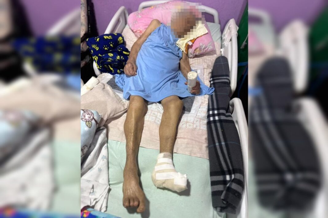 Uma idosa de 103 anos teve parte da perna amputada sem anestesia dentro de sua própria residência, no Distrito Federal (Foto: Instagram)