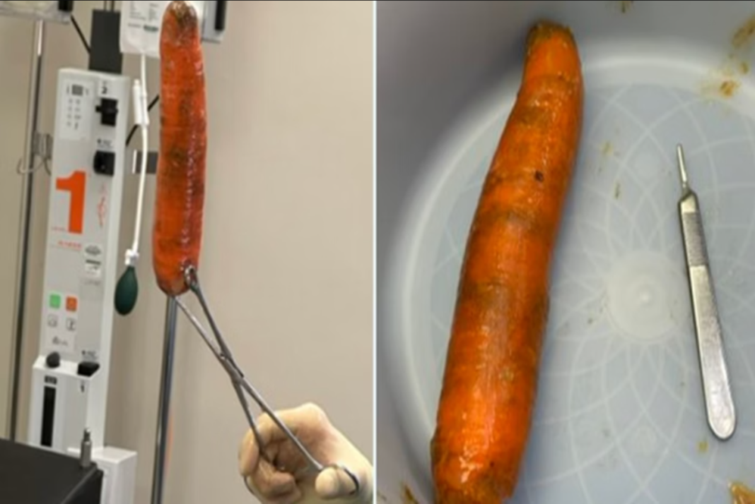 Um caso curioso envolvendo um legume terminou na emergência de um hospital nos Estados Unidos (Foto: X)