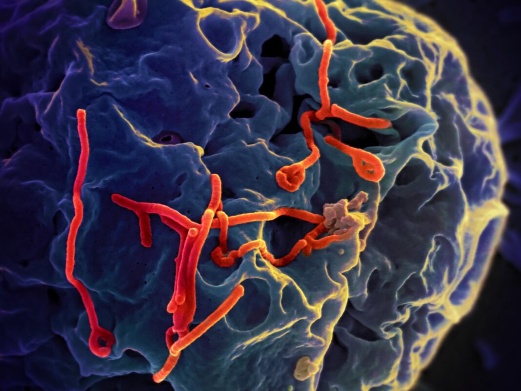 Pesquisadores dos Estados Unidos deram um passo importante no combate ao vírus Ebola, uma das doenças mais letais do planeta (Foto: X)