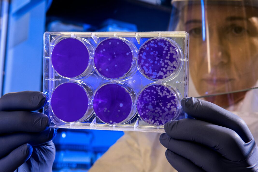 Pesquisadores identificaram uma possível ligação entre uma toxina produzida por bactérias intestinais e o aumento expressivo de casos de câncer colorretal em pessoas com menos de 50 anos. (Foto: Unsplash)