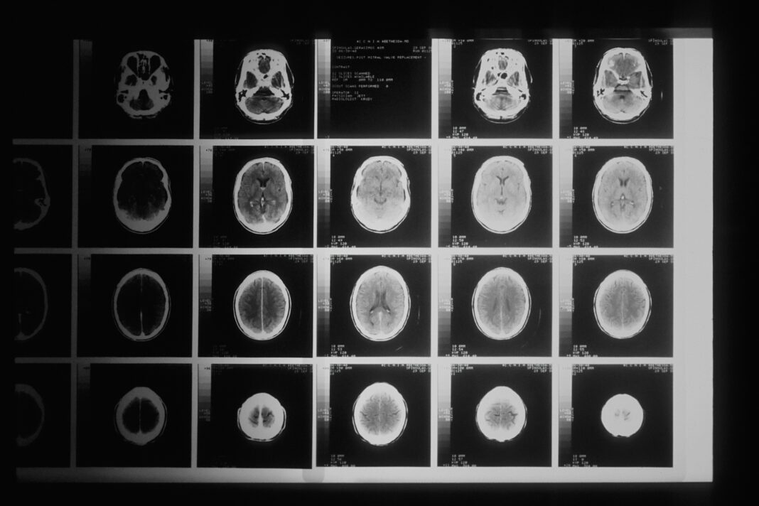 Cinco profissionais de enfermagem que atuam na ala de maternidade de um hospital em Boston, nos Estados Unidos, foram diagnosticadas com tumores cerebrais (Foto: Unsplash)