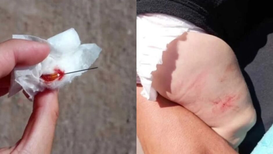 Uma mãe viveu momentos de desespero ao perceber que seu bebê de quatro meses havia ficado com uma agulha presa na perna depois de ser vacinado em um posto de saúde de Florencio Varela, no Paraguai (Foto: X)
