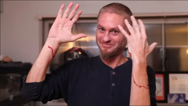 Um experimento extremo realizado por um norte-americano ao longo de 17 anos pode ter aberto caminho para um avanço médico inédito no combate ao envenenamento por cobras (Foto: X)