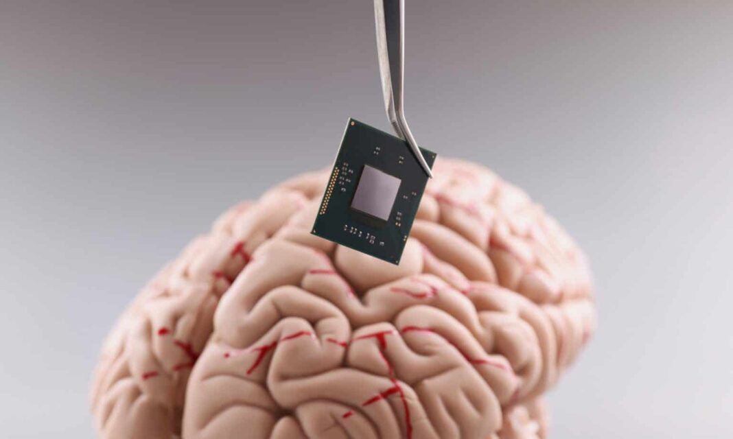A China deu um passo importante na corrida global por tecnologias de interface cérebro-computador (ICC). Pesquisadores do Hospital Huashan da Universidade Fudan, em Xangai, realizaram o primeiro teste clínico em humanos de um chip cerebral totalmente invasivo (Foto: X)