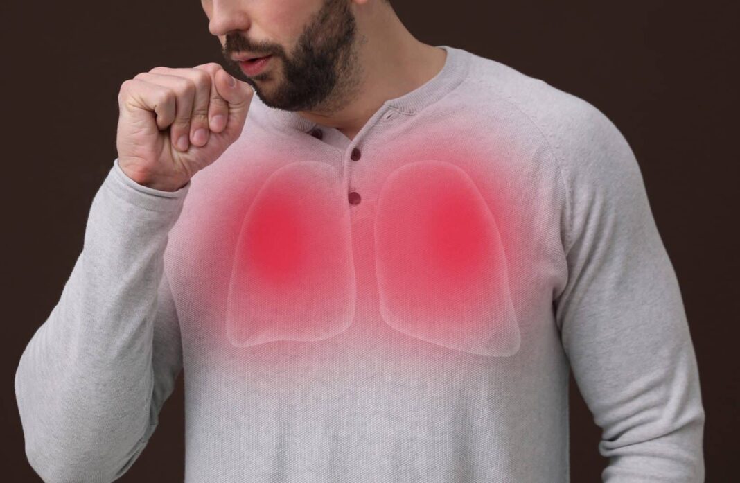 Pneumonia silenciosa avança sem alarde e preocupa médicos durante o inverno (Foto: X)