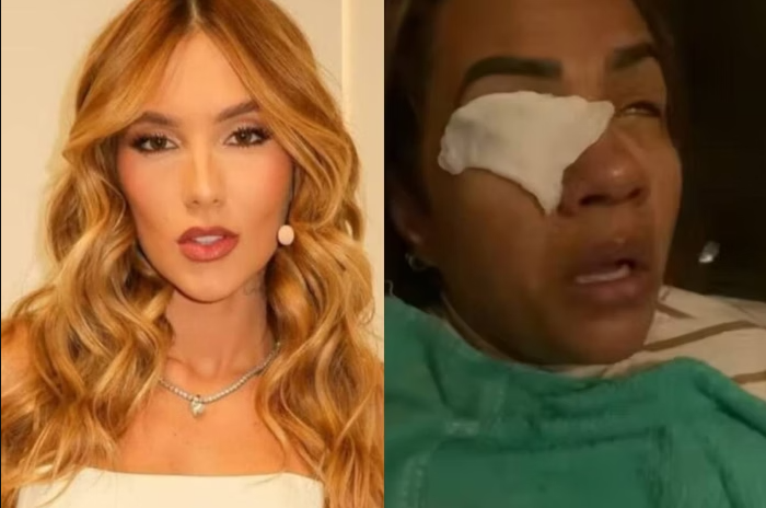 O caso da consumidora que relatou ter sofrido queimaduras na córnea após o uso de um cosmético da marca WePink, da influenciadora Virginia Fonseca, acendeu um alerta entre profissionais da saúde. (Foto: X)