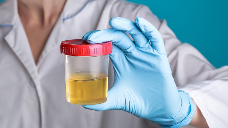 Atualmente, esse material é extraído de rochas ou obtido por processos químicos que costumam ser mais caros e poluentes (Foto: X)