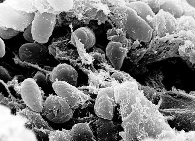 Um morador de South Lake Tahoe, na Califórnia, testou positivo para peste bubônica após provável contato com uma pulga infectada durante um acampamento na região. (Foto: X)