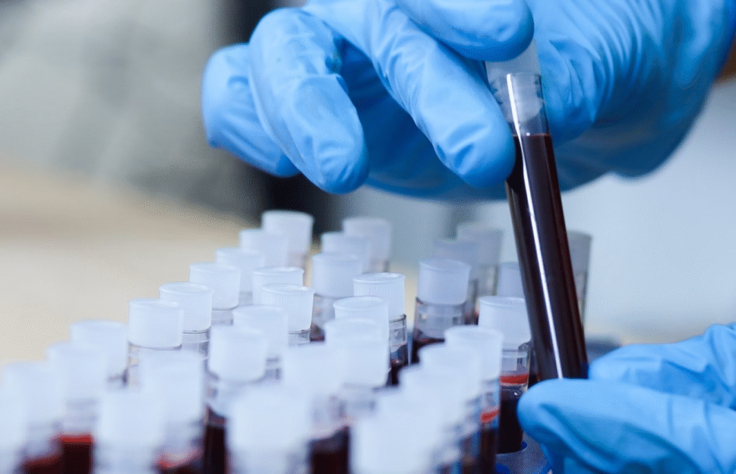 Um estudo publicado em 25 de julho na revista Aging revelou um passo importante para entender o chamado “efeito rejuvenescedor” do sangue jovem sobre a pele. (Foto: X)