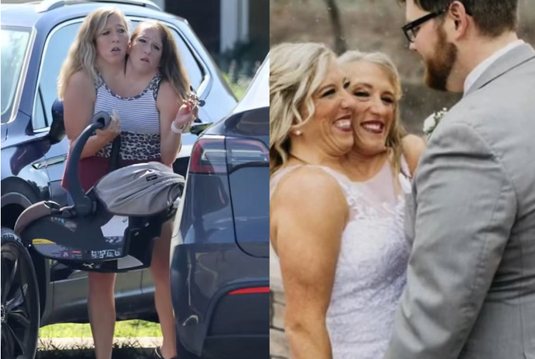 As gêmeas siamesas Abby e Brittany Hensel, de 35 anos, voltaram a chamar atenção ao surgirem em público acompanhadas de um bebê em New Brighton, Minnesota, no último dia 27 de agosto (Foto: X)
