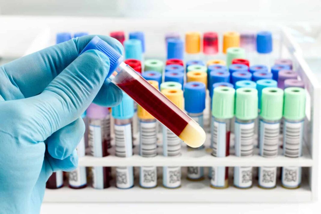 Em cerca de dez dias, essas estruturas começam a produzir sangue visível a olho nu, um feito inédito na área (Foto; X)