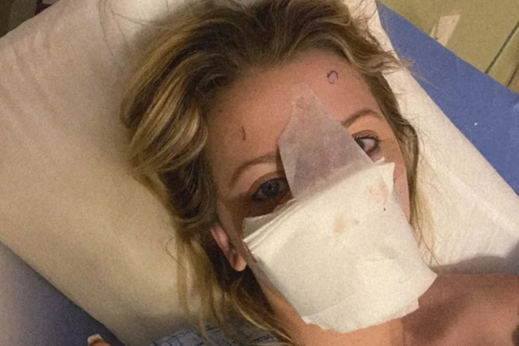 “Esse cachorro poderia ter me matado. Se tivesse continuado me mordendo, eu estaria morta”, contou a jovem nas redes sociais, onde compartilha detalhes do processo de recuperação (Foto; X)