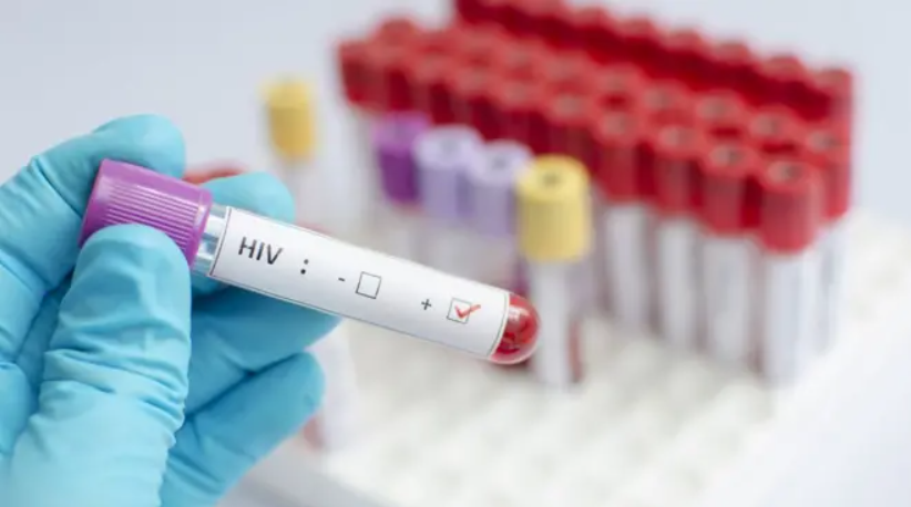 Nos episódios anteriores, a cura ocorreu após transplantes de doadores portadores de uma mutação genética rara, conhecida como CCR5 Δ32, presente nas duas cópias do gene responsável por um receptor usado pelo HIV para entrar nas células (Foto: X)
