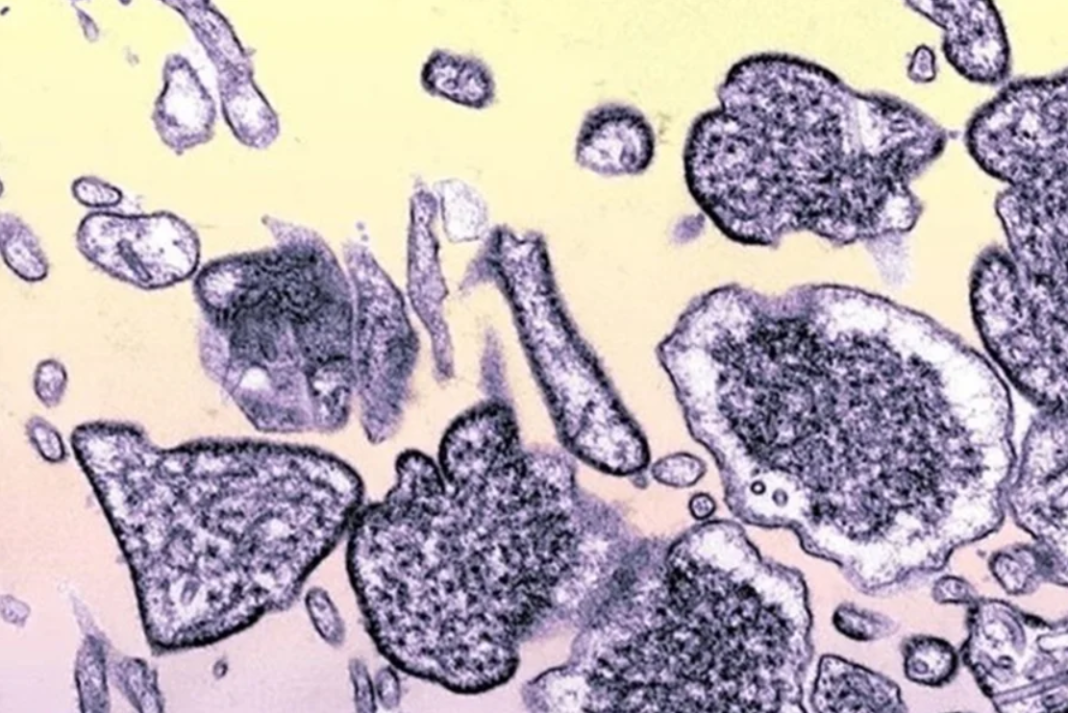 O Ministério da Saúde esclareceu que não há registro de casos confirmados do vírus Nipah no Brasil (Foto: X)