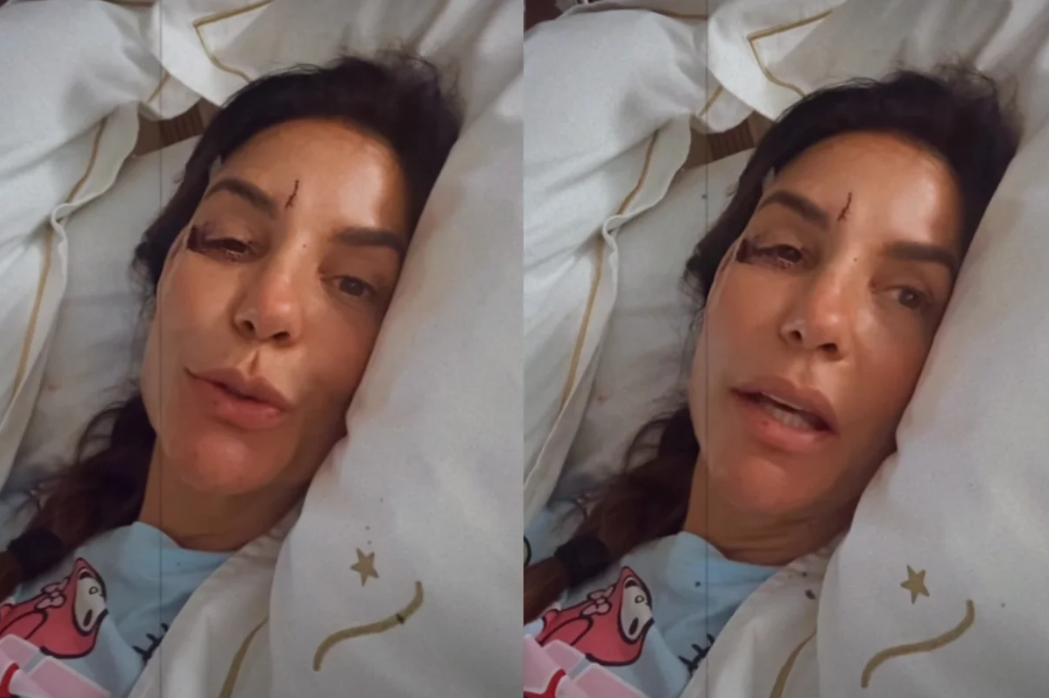 A cantora Ivete Sangalo, de 53 anos, usou as redes sociais nesta quarta-feira (25/2) para explicar um acidente doméstico que resultou em sua internação (Foto: X)
