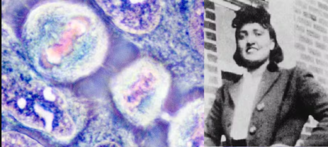 A história de Henrietta Lacks, mulher cujas células transformaram a medicina moderna sem que ela soubesse, voltou ao centro do debate científico e jurídico após novos desdobramentos envolvendo empresas farmacêuticas (Foto: X)