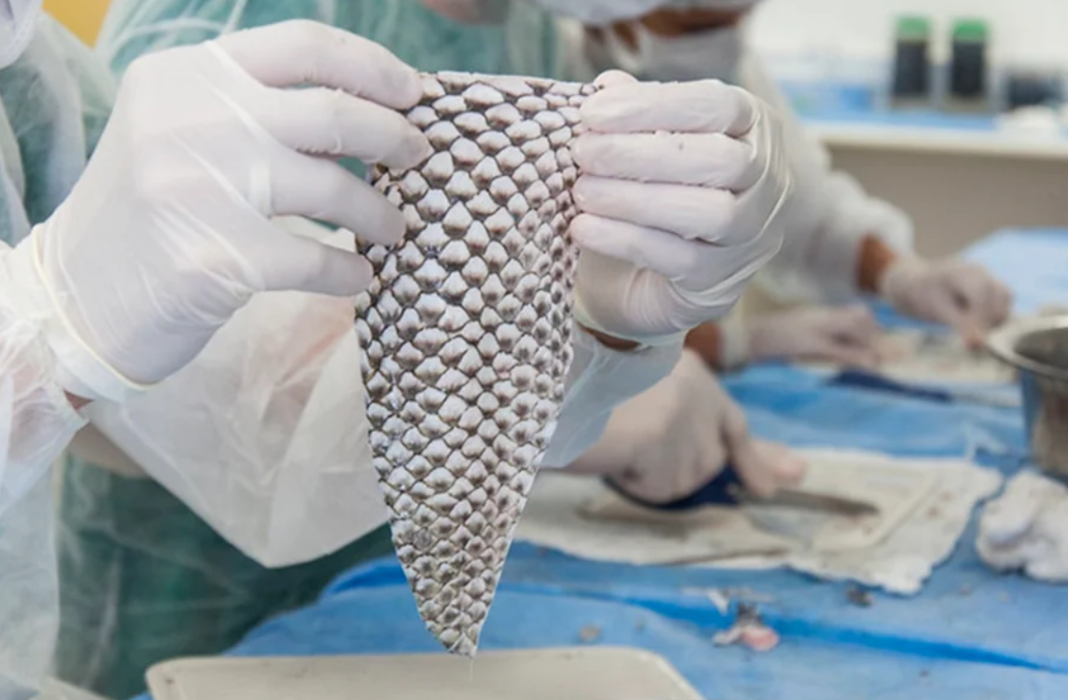Uma tecnologia desenvolvida no Brasil vem ganhando destaque internacional ao transformar pele de tilápia em um curativo biológico usado no tratamento de queimaduras e outras aplicações médicas (Foto: X)