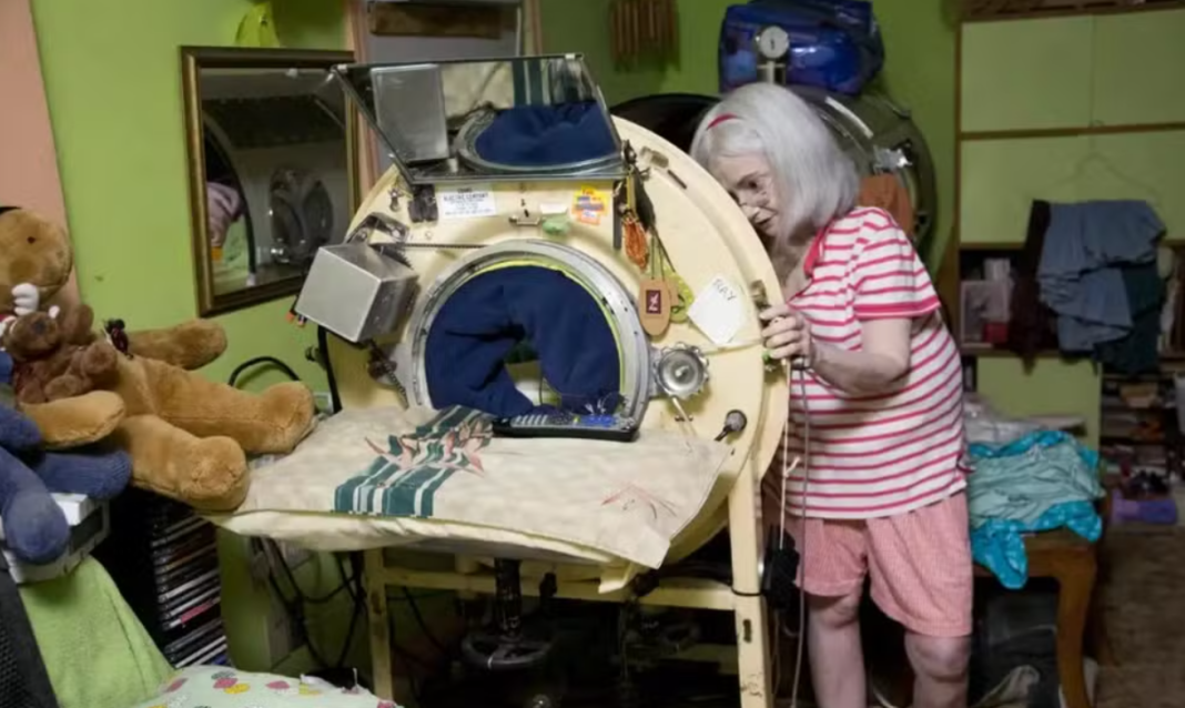Martha Ann Lillard, considerada a última pessoa nos Estados Unidos a depender de um pulmão de aço para respirar, morreu aos 78 anos (Foto: X)