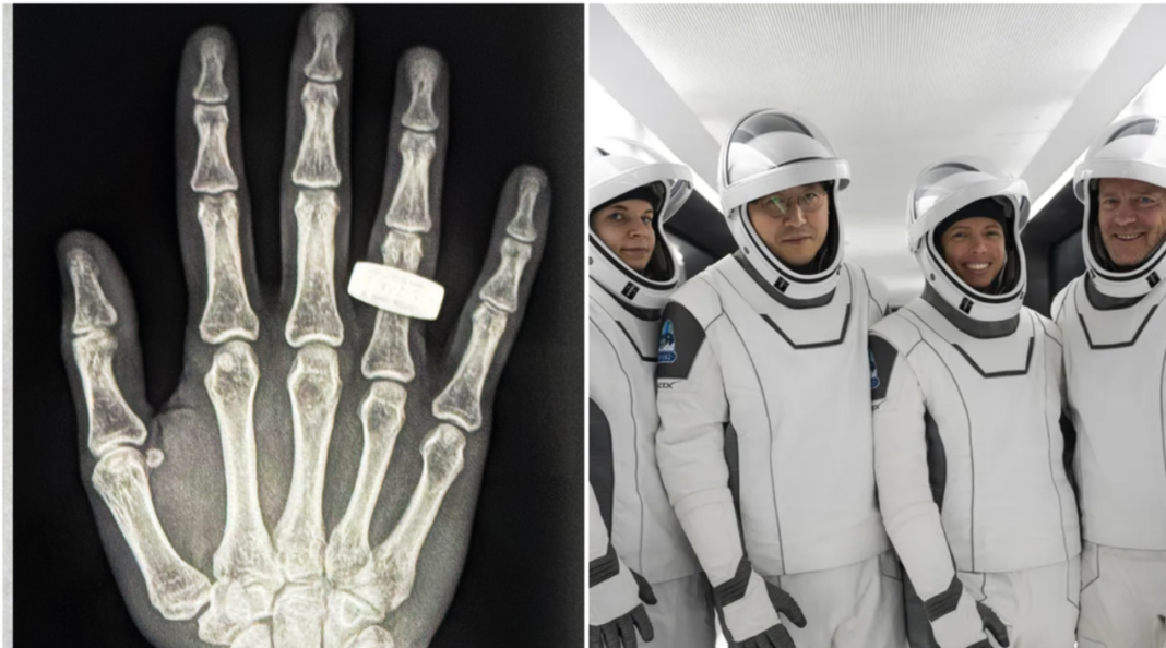 Astronautas conseguiram realizar, pela primeira vez, exames de raio-X em órbita com qualidade suficiente para uso diagnóstico (Foto: X)